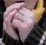Минздрав Коми распространил памятку "Обморожения" - Ухтинский еженедельник НЭП