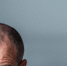 За 30 дней — густая шевелюра: втираю дешманские капли в плешь — и вместо "залысин" густая щетка волос плотничком пошла - Pro Город Ухта